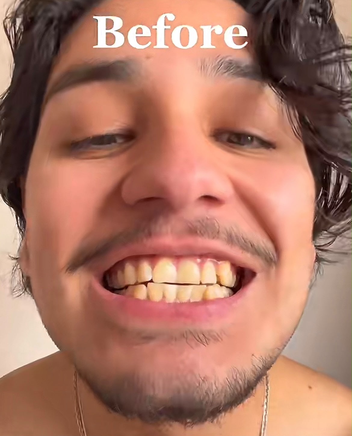 ASCEND 3D CHARCOAL WHITENING STRIPS™