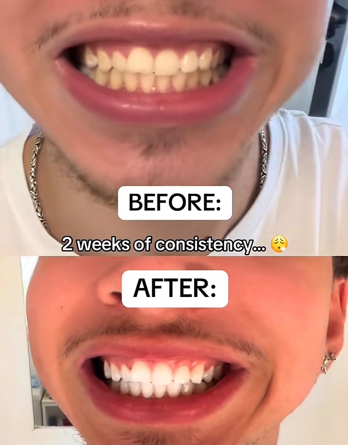 ASCEND 3D CHARCOAL WHITENING STRIPS™